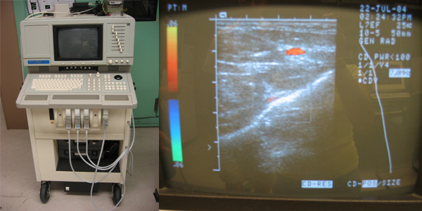 Ultrasound machinery and sample imaging